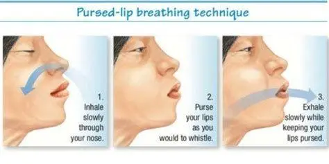 Teknik Pernapasan Pursed-Lip Ilustrasi teknik pernapasan pursed lip breathing