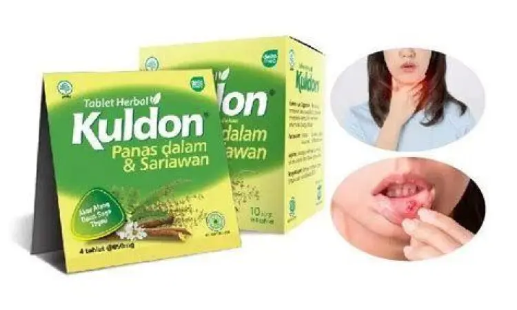 Obat sariawan medis dan alami