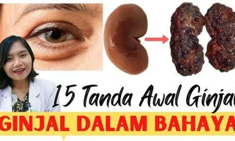 tanda awal penurunan fungsi ginjal