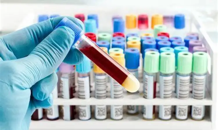 tes laboratorium fungsi ginjal