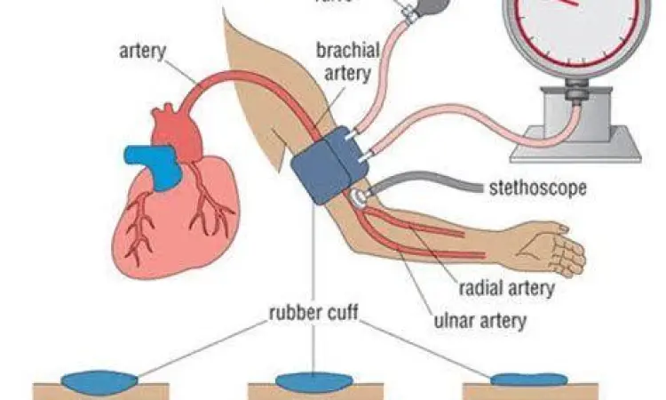 Proses pengukuran tensi darah normal pada orang dewasa