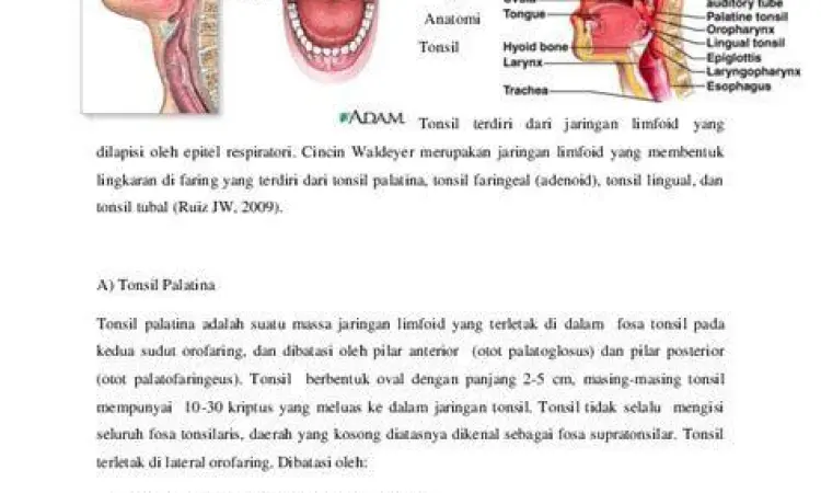 Anatomi tonsil manusia yang meradang
