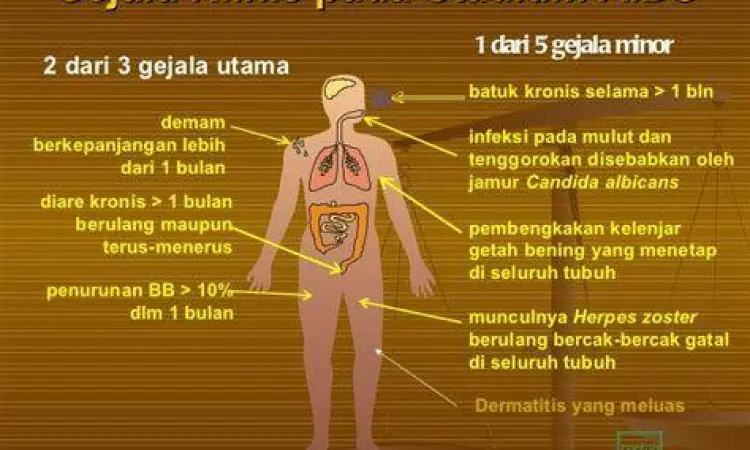 Ilustrasi penderita demam sebagai gejala awal HIV
