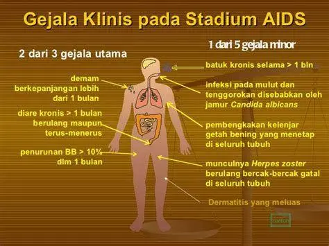 Gejala Demam pada HIV Ilustrasi penderita demam sebagai gejala awal HIV