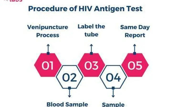 Prosedur tes darah HIV di laboratorium