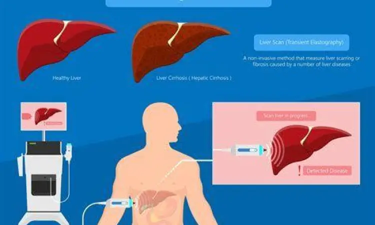 Pemeriksaan Fibroscan Prosedur pemeriksaan Fibroscan untuk hati