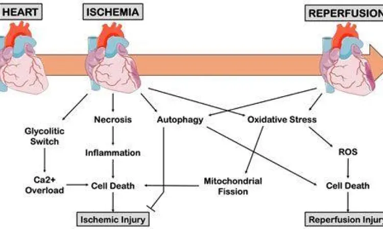 Mekanisme penyempitan arteri koroner yang menyebabkan angina