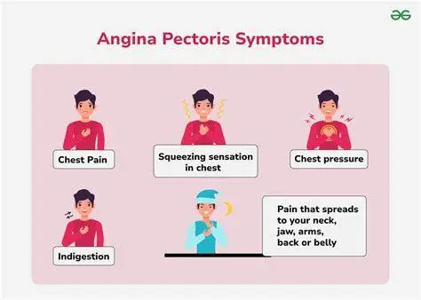 Peta Nyeri Angina Lokasi persebaran nyeri angina pada tubuh manusia