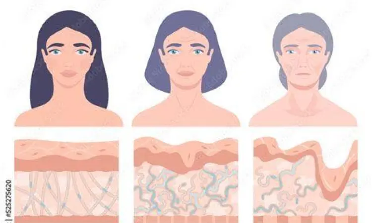 Diagram proses penuaan kulit manusia