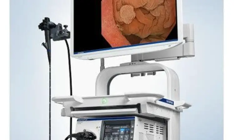 Prosedur endoskopi untuk cek lambung