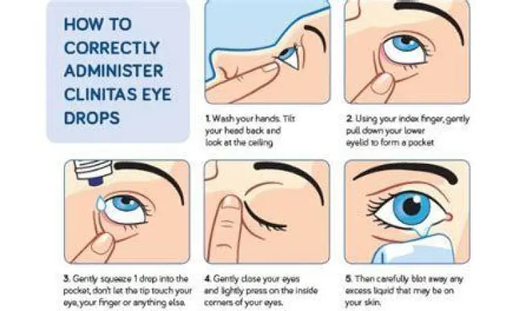 Cara meneteskan obat mata dengan benar