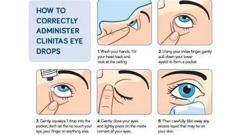 Teknik Tetes Mata Cara meneteskan obat mata dengan benar