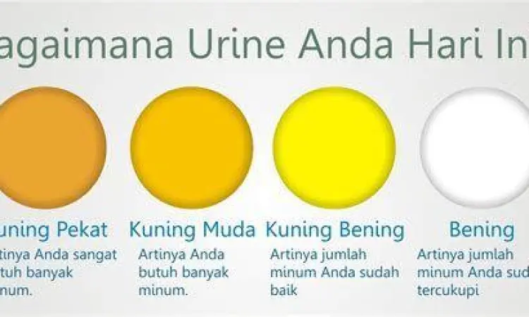 Perbandingan warna urine normal dan urine penderita ginjal