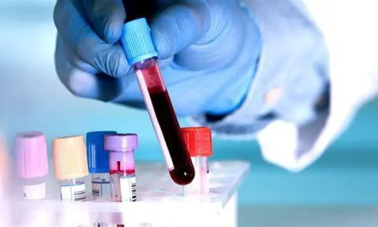 Proses pemeriksaan medis untuk fungsi ginjal