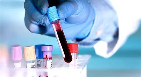 Diagnosis Medis Ginjal Proses pemeriksaan medis untuk fungsi ginjal