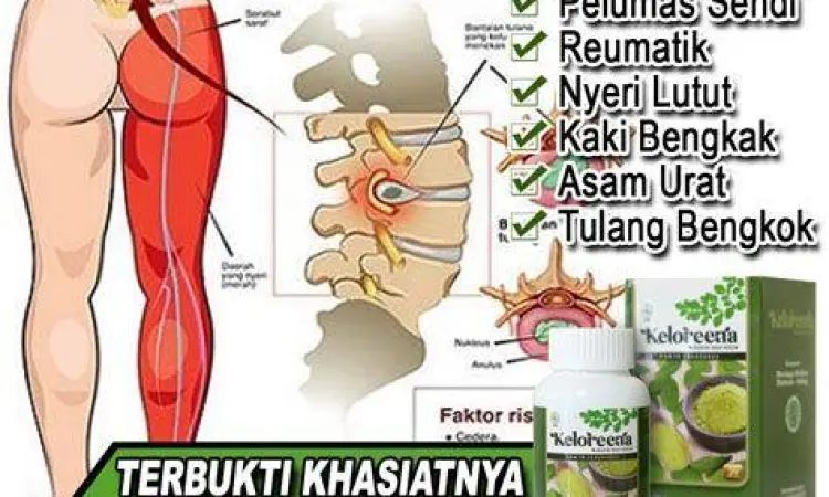Ramuan herbal jahe dan kunyit untuk nyeri pinggang