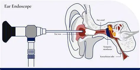 Mekanisme Serumen Diagram mekanisme kerja surfaktan pada serumen