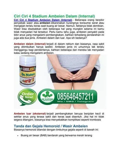 Stadium Ambeien Ilustrasi perbedaan stadium ambeien dari derajat satu hingga empat