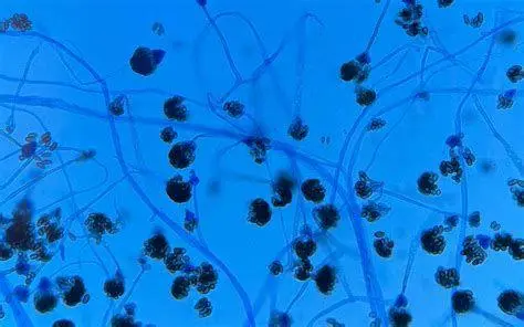 Stachybotrys Chartarum Mikroskopis Tampilan mikroskopis spora jamur Stachybotrys chartarum