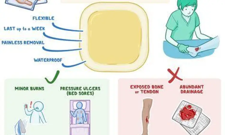 Perban Anti Air untuk Berenang Plester hidrokoloid untuk berenang